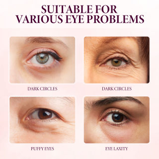 Mango Eye Cream, Reduces Fine Lines and Firms Skin 5
